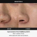 Age-R Booster H – a Facial Treatment Device