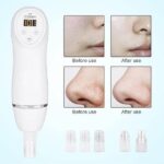 Professional Blackhead Remover Vacuum Amazon